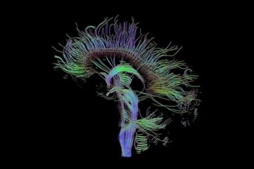 Neuroscience: Big Brain