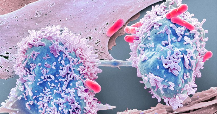 Using data science to beat cancer