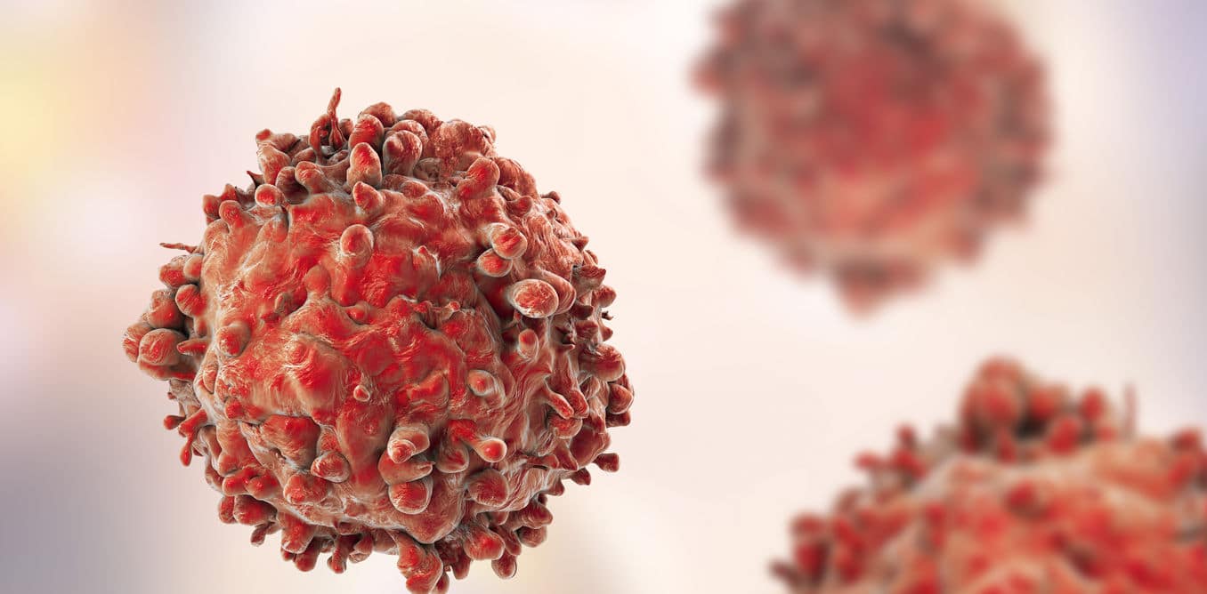 How big data is being mobilised in the fight against leukaemia