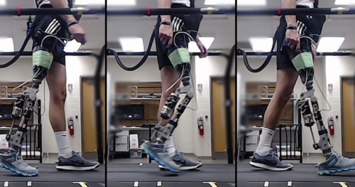 AI Helps Amputees Walk With a Robotic Knee