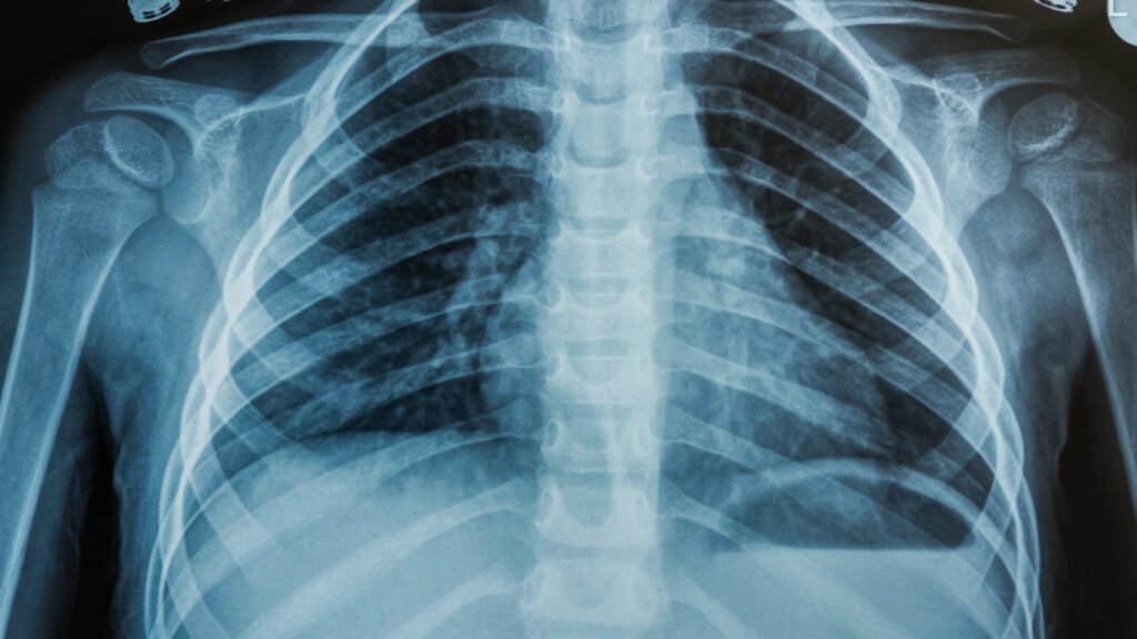 Advancing AI in health care: it's all about trust