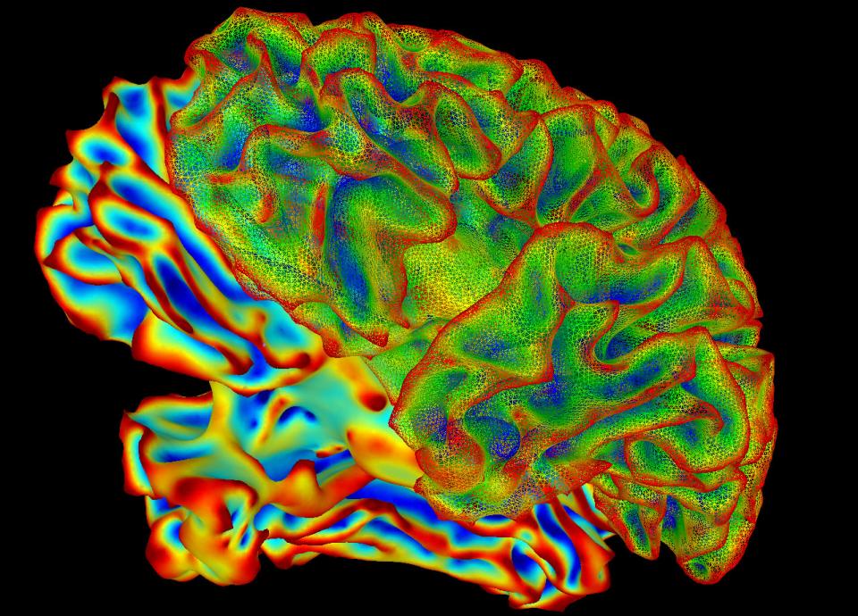 What Can AI Learn from Human Intelligence?
