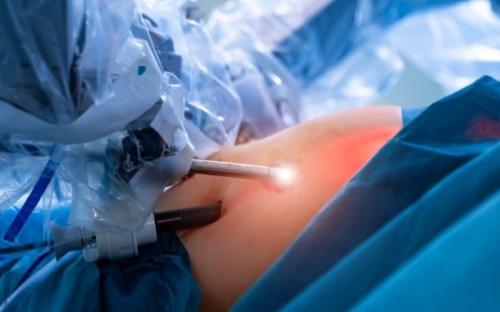 Robotic Surgery Is Safer and Improves Patient Recovery Time