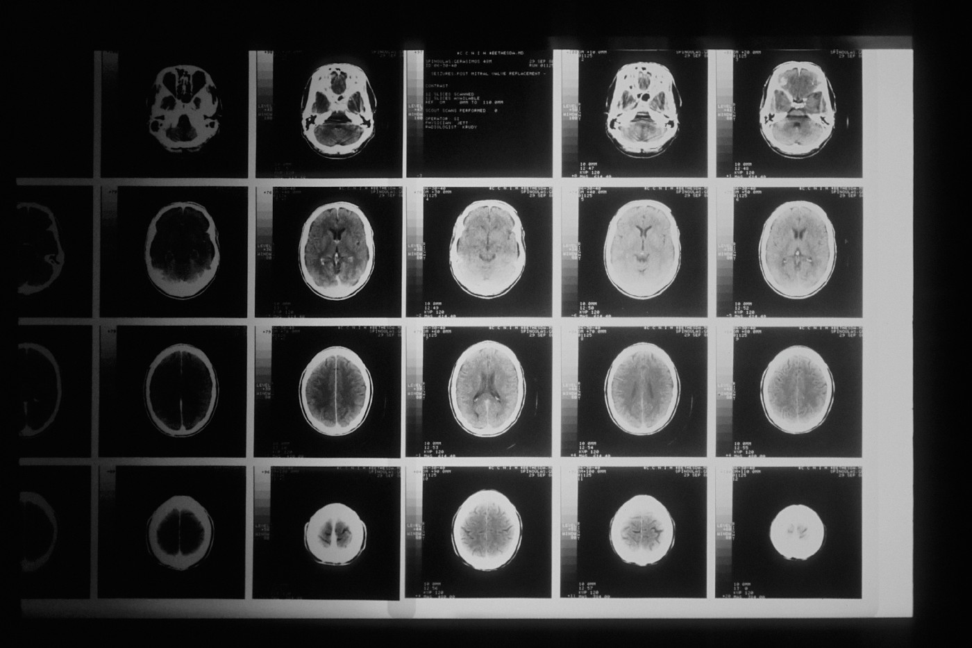 Building the bridge between AI and biotech